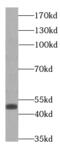 Post-GPI Attachment To Proteins 3 antibody, FNab06318, FineTest, Western Blot image 