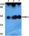 Proteasome 26S Subunit, ATPase 3 antibody, A07208, Boster Biological Technology, Western Blot image 