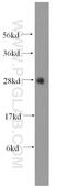 Methyltransferase Like 7B antibody, 17001-1-AP, Proteintech Group, Western Blot image 