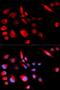 Kinesin-like protein KIF2C antibody, LS-C334067, Lifespan Biosciences, Immunofluorescence image 