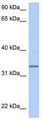 Chromosome 3 Open Reading Frame 62 antibody, TA333352, Origene, Western Blot image 