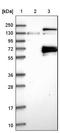 Chondroitin Sulfate N-Acetylgalactosaminyltransferase 2 antibody, NBP1-81851, Novus Biologicals, Western Blot image 
