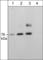 Sphingomyelin phosphodiesterase 3 antibody, SP4061, ECM Biosciences, Western Blot image 