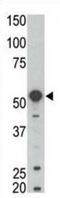 BLK Proto-Oncogene, Src Family Tyrosine Kinase antibody, abx033629, Abbexa, Western Blot image 