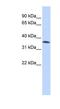 Zinc Finger C2HC-Type Containing 1A antibody, NBP1-79991, Novus Biologicals, Western Blot image 