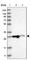 Mitochondrial Ribosomal Protein L10 antibody, HPA021234, Atlas Antibodies, Western Blot image 