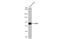 DEAD-Box Helicase 4 antibody, GTX116575, GeneTex, Western Blot image 