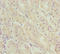 DDX11 antibody, LS-C675630, Lifespan Biosciences, Immunohistochemistry paraffin image 