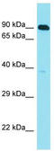 Chromosome 10 Open Reading Frame 120 antibody, TA334906, Origene, Western Blot image 