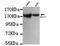 Histone Deacetylase 4 antibody, LS-C178294, Lifespan Biosciences, Western Blot image 