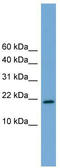 Cbp/P300 Interacting Transactivator With Glu/Asp Rich Carboxy-Terminal Domain 4 antibody, TA342331, Origene, Western Blot image 