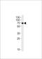 KLC1 antibody, 63-562, ProSci, Western Blot image 
