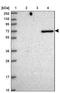 Netrin 3 antibody, NBP2-30487, Novus Biologicals, Western Blot image 