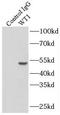 WT1 Transcription Factor antibody, FNab09528, FineTest, Immunoprecipitation image 