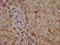 Coproporphyrinogen Oxidase antibody, CSB-PA005910LA01HU, Cusabio, Immunohistochemistry frozen image 