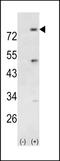 Phosphoinositide-3-Kinase Regulatory Subunit 5 antibody, LS-C101098, Lifespan Biosciences, Western Blot image 