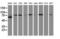 Catenin Beta 1 antibody, LS-C172583, Lifespan Biosciences, Western Blot image 
