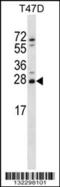 Zinc Finger Matrin-Type 2 antibody, 56-658, ProSci, Western Blot image 