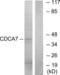Cell division cycle-associated protein 7 antibody, LS-C119445, Lifespan Biosciences, Western Blot image 