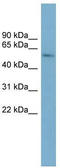 Cytochrome P450 Family 2 Subfamily A Member 7 antibody, TA346218, Origene, Western Blot image 