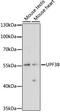 UPF3B Regulator Of Nonsense Mediated MRNA Decay antibody, LS-C750156, Lifespan Biosciences, Western Blot image 