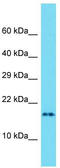 Putative uncharacterized protein C14orf184 antibody, TA335927, Origene, Western Blot image 
