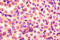 Proteasome subunit beta type-2 antibody, A52680-100, Epigentek, Immunohistochemistry paraffin image 