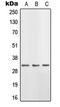 Hydroxysteroid 11-Beta Dehydrogenase 1 antibody, LS-C352324, Lifespan Biosciences, Western Blot image 