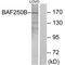 AT-Rich Interaction Domain 1B antibody, PA5-49852, Invitrogen Antibodies, Western Blot image 