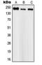 Sodium channel protein type 1 subunit alpha antibody, MBS821462, MyBioSource, Western Blot image 