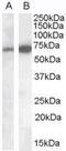 Cell Adhesion Molecule 4 antibody, GTX88956, GeneTex, Western Blot image 