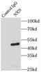 Nucleoredoxin antibody, FNab05944, FineTest, Immunoprecipitation image 