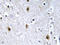 Insulin Receptor Substrate 1 antibody, AP20710PU-N, Origene, Immunohistochemistry frozen image 
