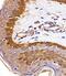 S100 Calcium Binding Protein A2 antibody, M03698, Boster Biological Technology, Immunohistochemistry paraffin image 