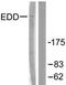 Ubiquitin Protein Ligase E3 Component N-Recognin 5 antibody, orb95994, Biorbyt, Western Blot image 