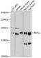 Ribosomal RNA Processing 12 Homolog antibody, 14-874, ProSci, Western Blot image 