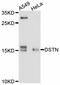 Destrin, Actin Depolymerizing Factor antibody, abx125787, Abbexa, Western Blot image 