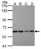 Proteasome 26S Subunit, Non-ATPase 3 antibody, GTX102291, GeneTex, Western Blot image 