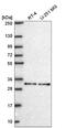 LXR beta antibody, NBP2-55918, Novus Biologicals, Western Blot image 