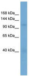Importin 5 antibody, TA335843, Origene, Western Blot image 