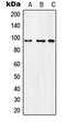 Microcephalin 1 antibody, MBS822326, MyBioSource, Western Blot image 