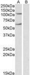 Iron Responsive Element Binding Protein 2 antibody, PA5-19158, Invitrogen Antibodies, Western Blot image 