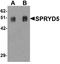 Tripartite Motif-Containing 51 antibody, A15117, Boster Biological Technology, Western Blot image 