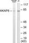 A-Kinase Anchoring Protein 8 antibody, EKC1634, Boster Biological Technology, Western Blot image 