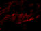 Zinc finger FYVE domain-containing protein 26 antibody, 5023, ProSci, Immunofluorescence image 