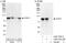 Signal Transducer And Activator Of Transcription 1 antibody, A302-752A, Bethyl Labs, Immunoprecipitation image 
