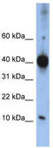 LSM4 Homolog, U6 Small Nuclear RNA And MRNA Degradation Associated antibody, TA343783, Origene, Western Blot image 