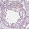 Protein Smaug homolog 1 antibody, NBP2-49440, Novus Biologicals, Immunohistochemistry paraffin image 