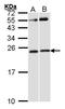 Rac Family Small GTPase 1 antibody, LS-C185382, Lifespan Biosciences, Western Blot image 