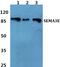 Semaphorin 3E antibody, PA5-75684, Invitrogen Antibodies, Western Blot image 